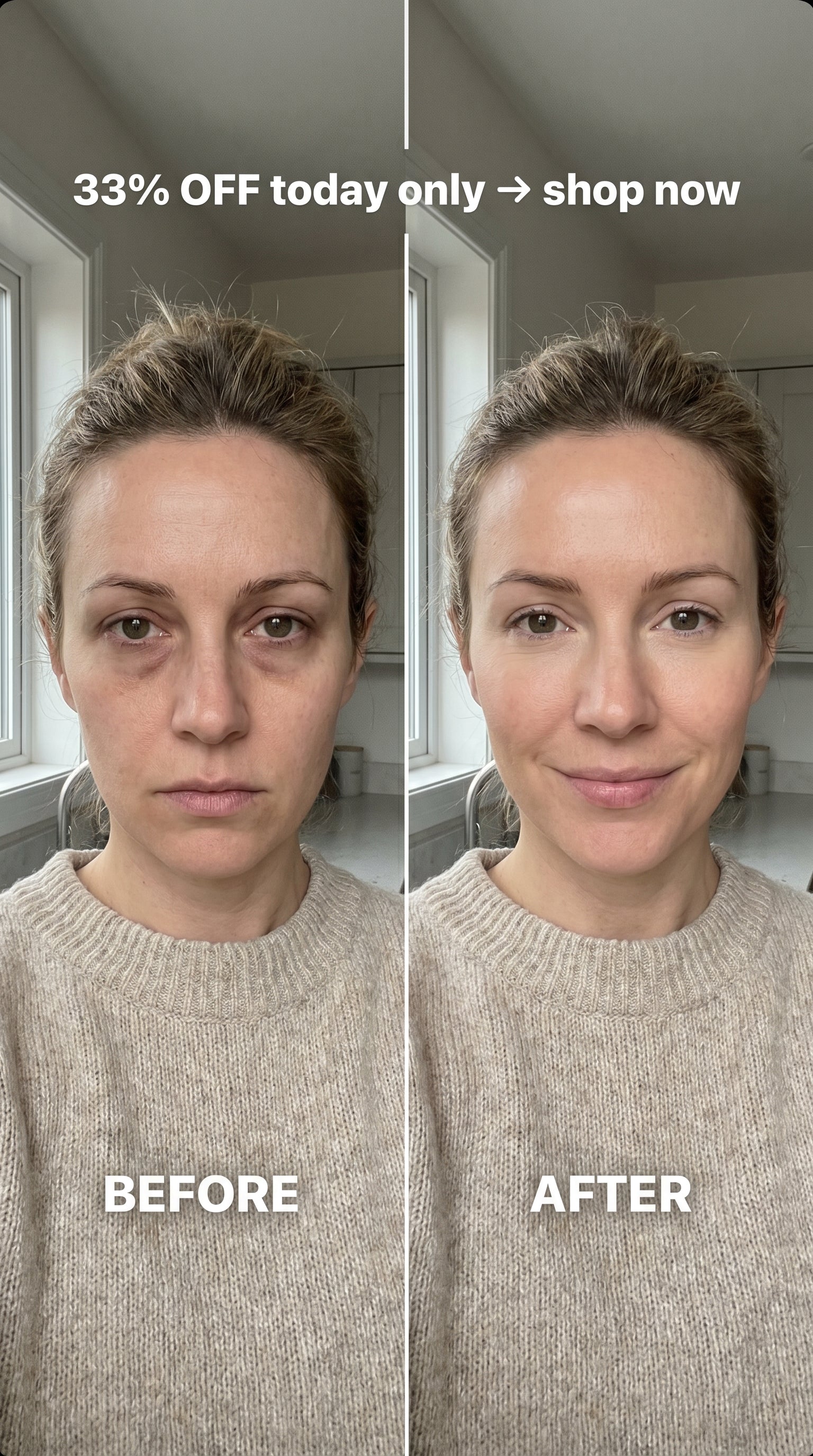 EYE BRIGHTENING COLLAGEN PATCHES